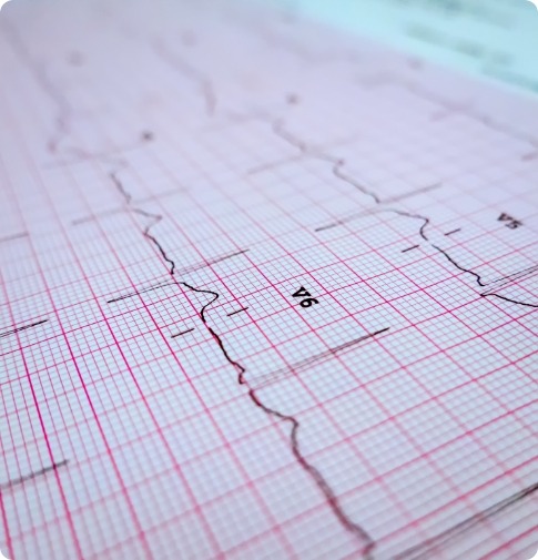 EKG Łomianki Górne, Dolne